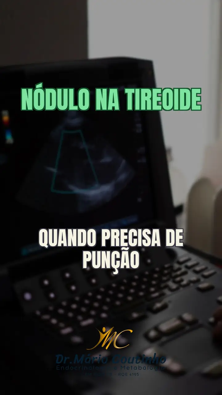 Nódulo na tireoide: quando a punção é necessária? Endocrinologista explica
