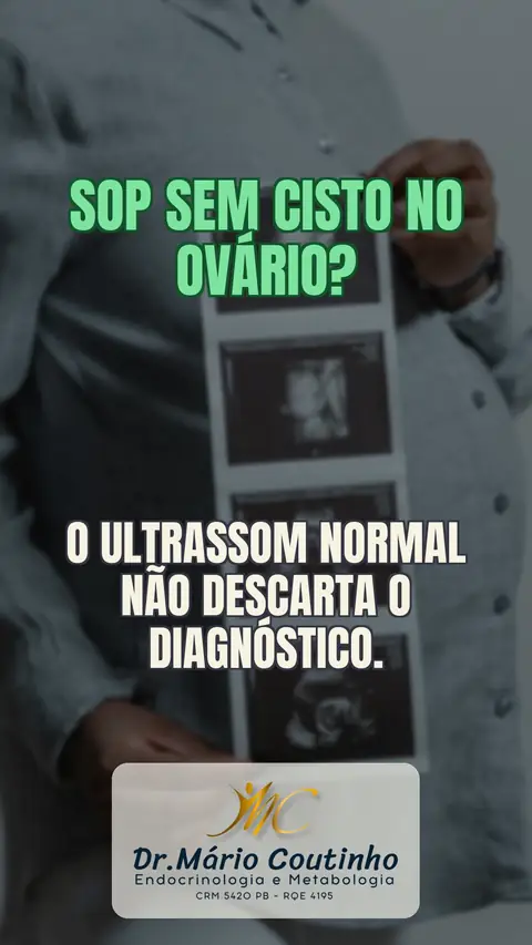 SOP sem cisto no ovário? Entenda os reais critérios
